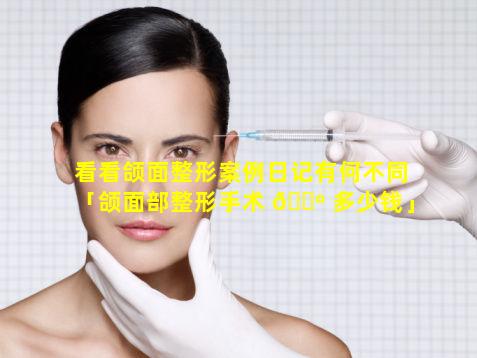 看看颌面整形案例日记有何不同「颌面部整形手术 🐺 多少钱」